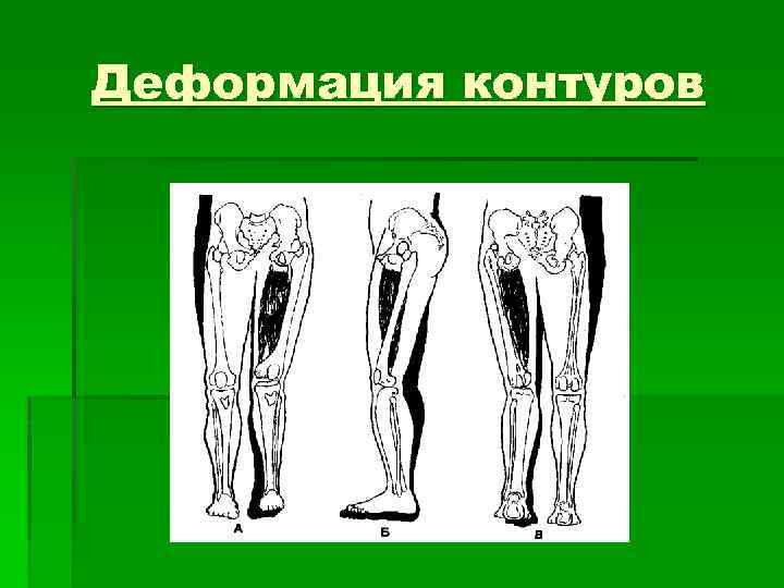 Деформация контуров 