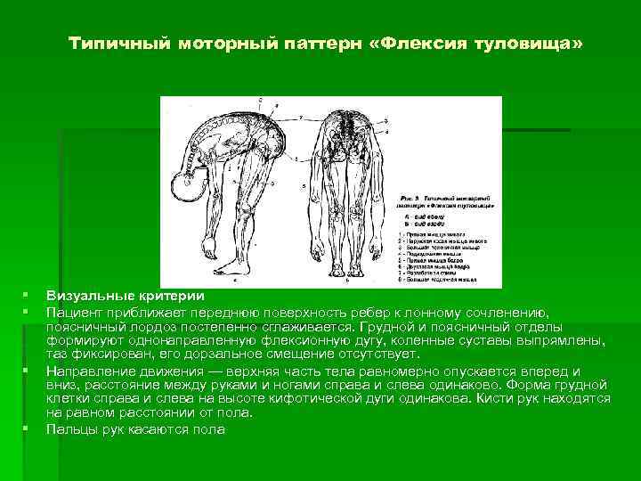 Типичный моторный паттерн «Флексия туловища» § § Визуальные критерии Пациент приближает переднюю поверхность ребер