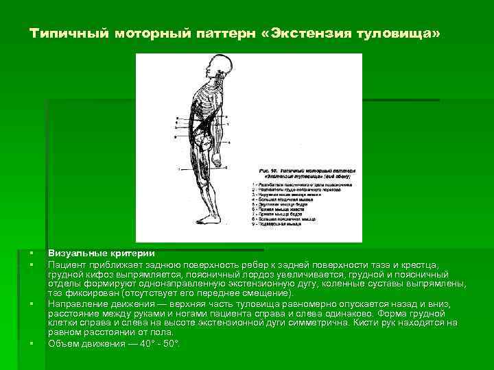 Типичный моторный паттерн «Экстензия туловища» § § Визуальные критерии Пациент приближает заднюю поверхность ребер