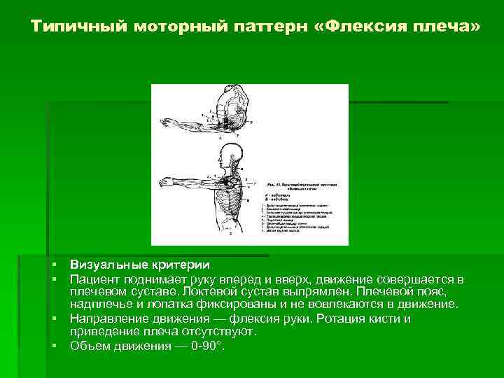 Типичный моторный паттерн «Флексия плеча» § Визуальные критерии § Пациент поднимает руку вперед и