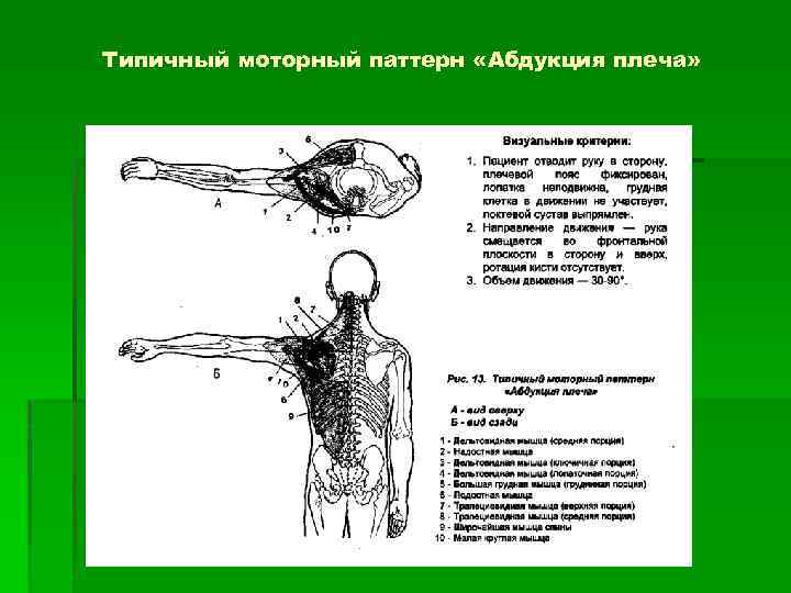 Типичный моторный паттерн «Абдукция плеча» 