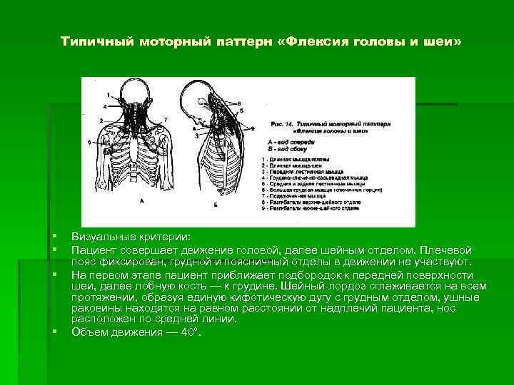 Типичный моторный паттерн «Флексия головы и шеи» § § Визуальные критерии: Пациент совершает движение