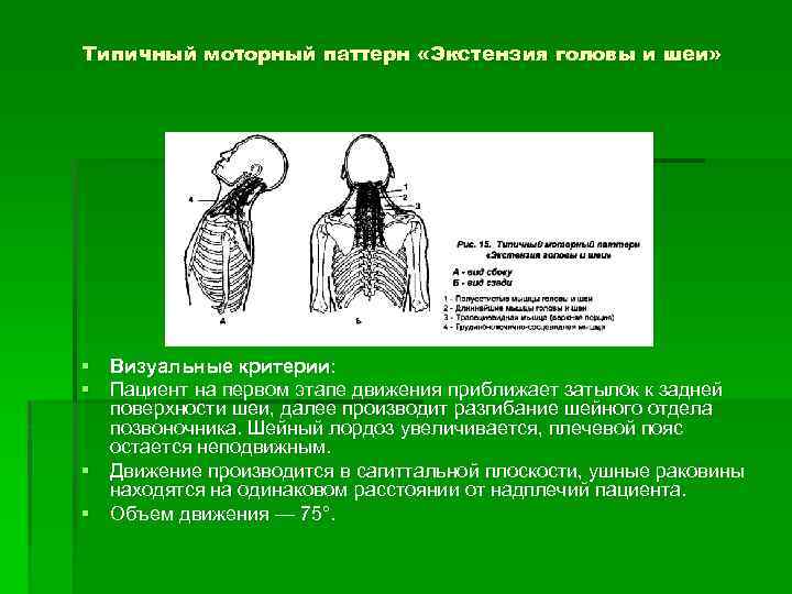 Типичный моторный паттерн «Экстензия головы и шеи» § Визуальные критерии: § Пациент на первом