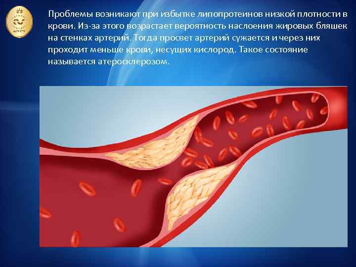 Проблемы возникают при избытке липопротеинов низкой плотности в крови. Из-за этого возрастает вероятность наслоения