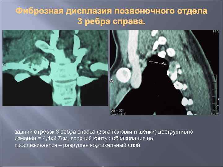 Диагностика опухолей презентация