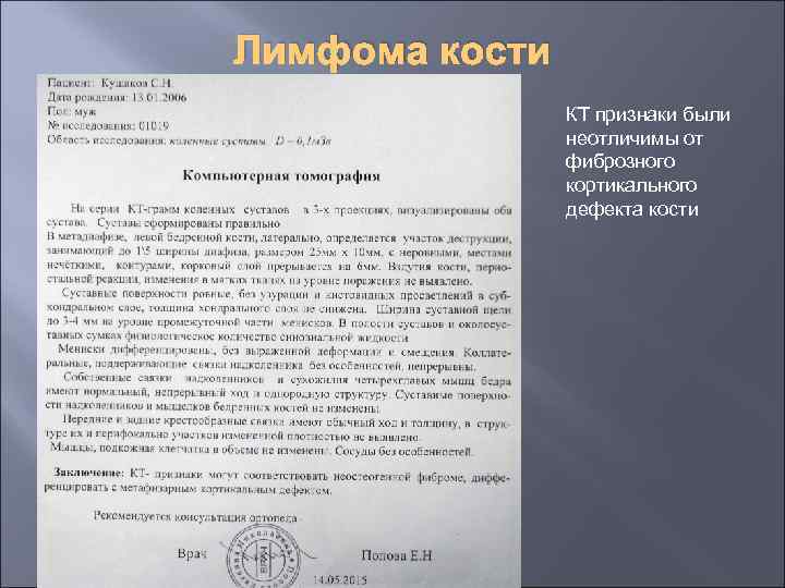 Лимфома кости КТ признаки были неотличимы от фиброзного кортикального дефекта кости 