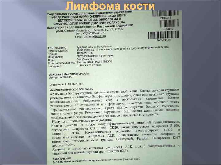 Лимфома кости 