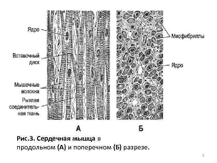 Схема вставочного диска - 89 фото