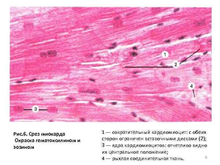 Рис. 6. Срез миокарда Окраска гематоксилином и эозином 1 — сократительный кардиомиоцит: с обеих