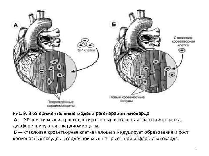 Рис. 9. Экспериментальные модели регенерации миокарда. А — SP клетки мыши, трансплантированные в область