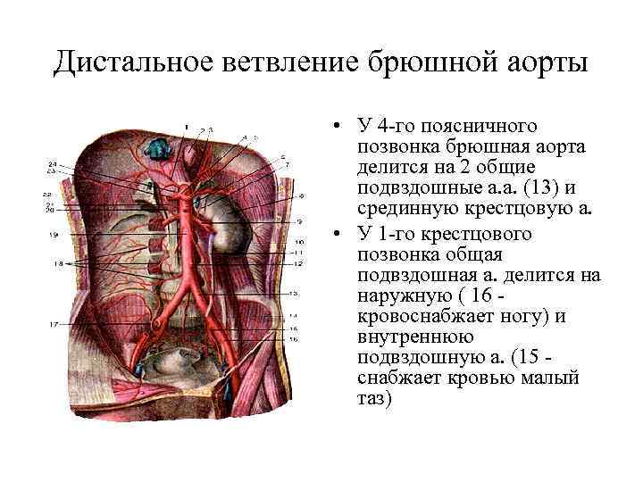 Аневризма брюшной аорты фото