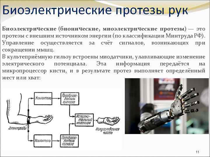 Биоэлектрические протезы рук Биоэлектрические (бионические, миоэлектрические протезы) — это протезы с внешним источником энергии