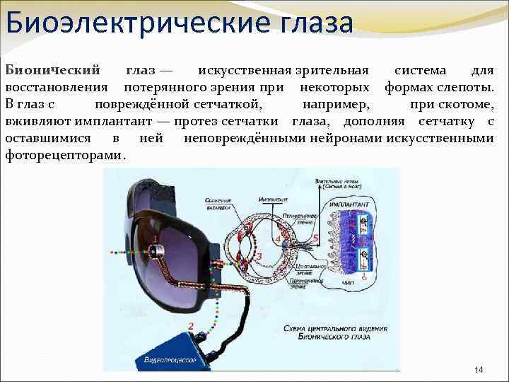 Биоэлектрические глаза Бионический глаз — искусственная зрительная система для восстановления потерянного зрения при некоторых