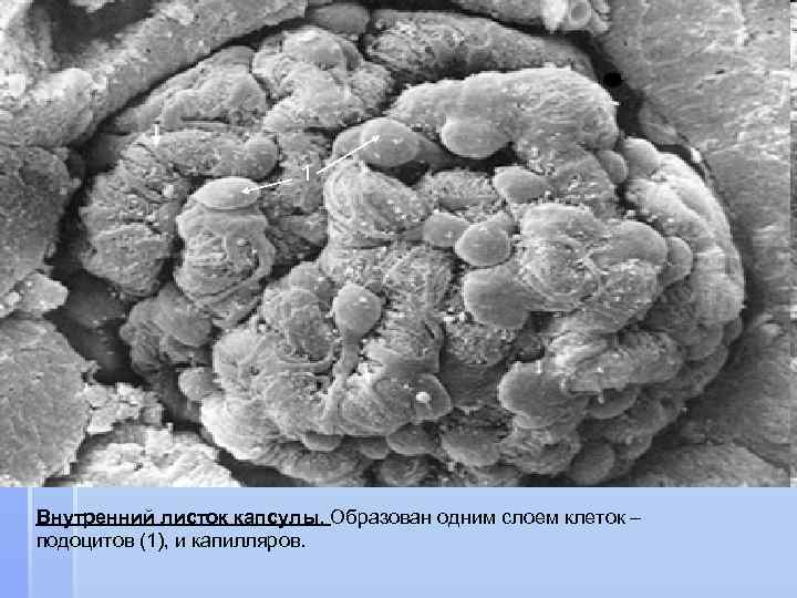1 Внутренний листок капсулы. Образован одним слоем клеток – подоцитов (1), и капилляров. 