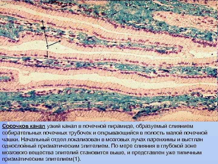 1 Сосочков канал узкий канал в почечной пирамиде, образуемый слиянием собирательных почечных трубочек и