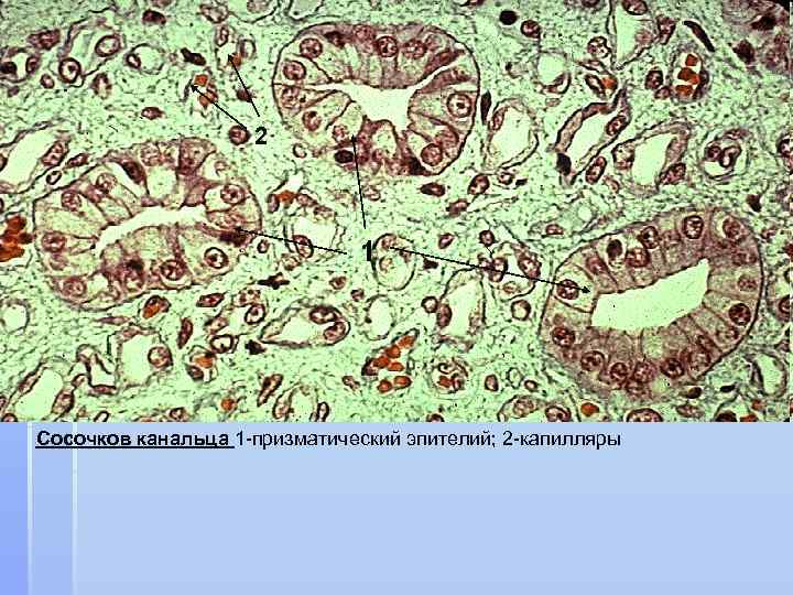 2 1 Сосочков канальца 1 -призматический эпителий; 2 -капилляры 