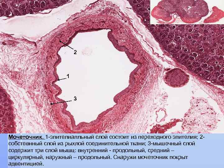 2 2 1 1 3 3 Мочеточник. 1 -эпителиалльный слой состоит из переходного эпителия;
