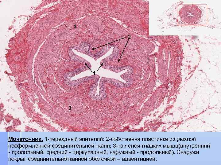 3 2 1 3 Мочеточник. 1 -перехдный эпителий; 2 -собствення пластинка из рыхлой неоформленной