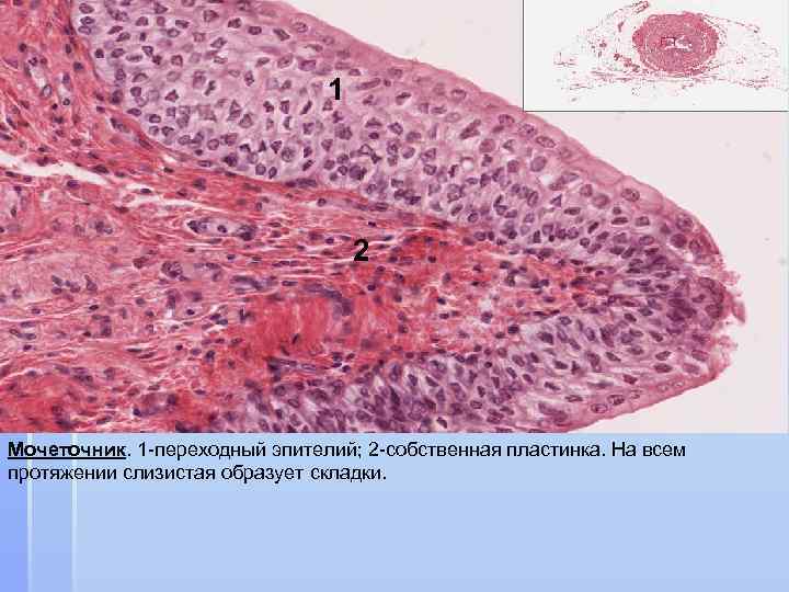 1 2 Мочеточник. 1 -переходный эпителий; 2 -собственная пластинка. На всем протяжении слизистая образует