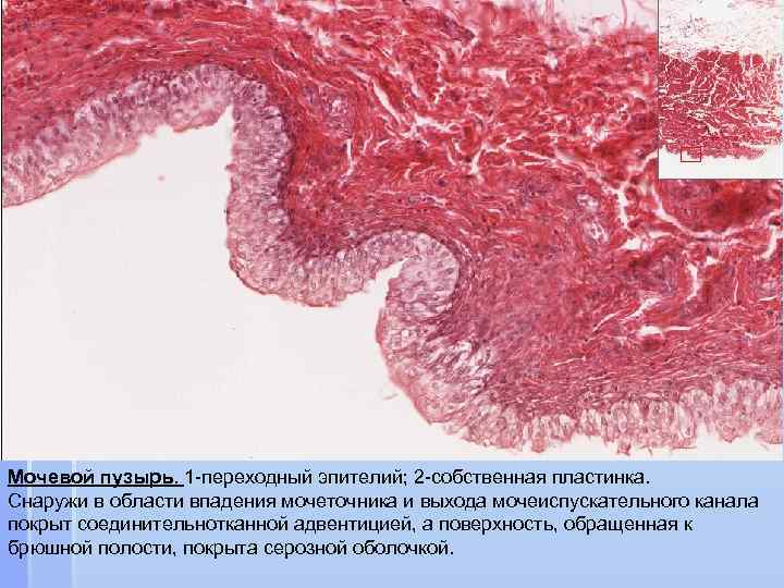 Мочевой пузырь. 1 -переходный эпителий; 2 -собственная пластинка. Снаружи в области впадения мочеточника и