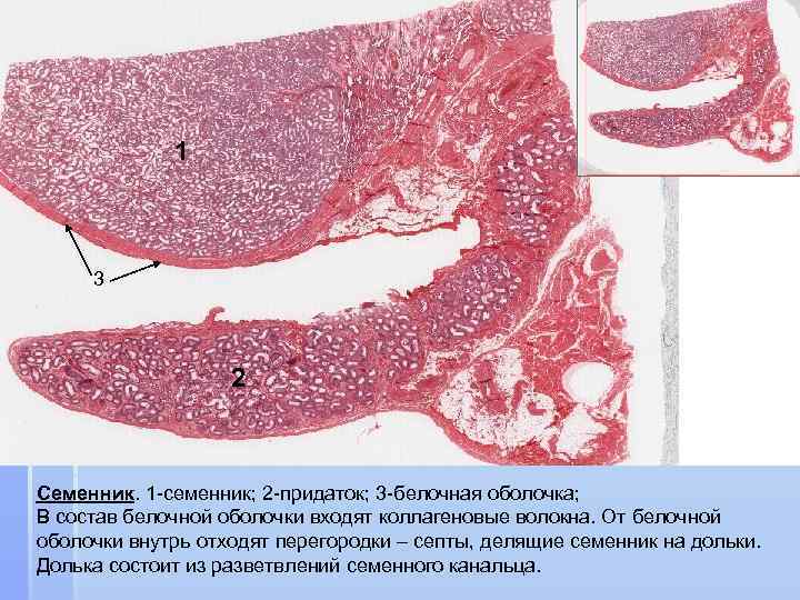 1 3 2 Семенник. 1 -семенник; 2 -придаток; 3 -белочная оболочка; В состав белочной