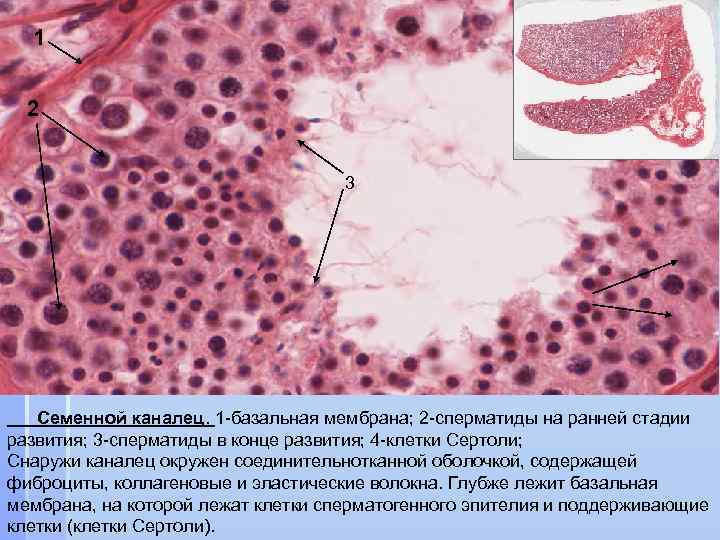 1 2 3 3 4 Семенной каналец. 1 -базальная мембрана; 2 -сперматиды на ранней