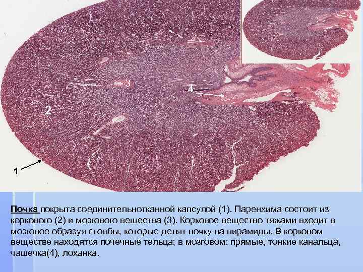 Паренхима печени что это. Паренхима соединительная ткань. Паренхима органа это. Строма и паренхима почки.