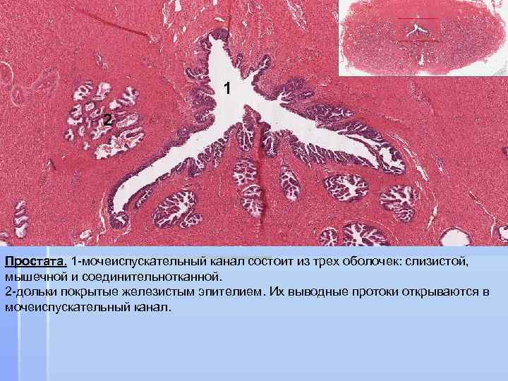 1 2 Простата. 1 -мочеиспускательный канал состоит из трех оболочек: слизистой, мышечной и соединительнотканной.