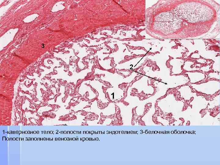 Пещеристое тело. Кавернозные тела гистология. Пещеристое тело гистология. Кавернозная пещеристая ткань.