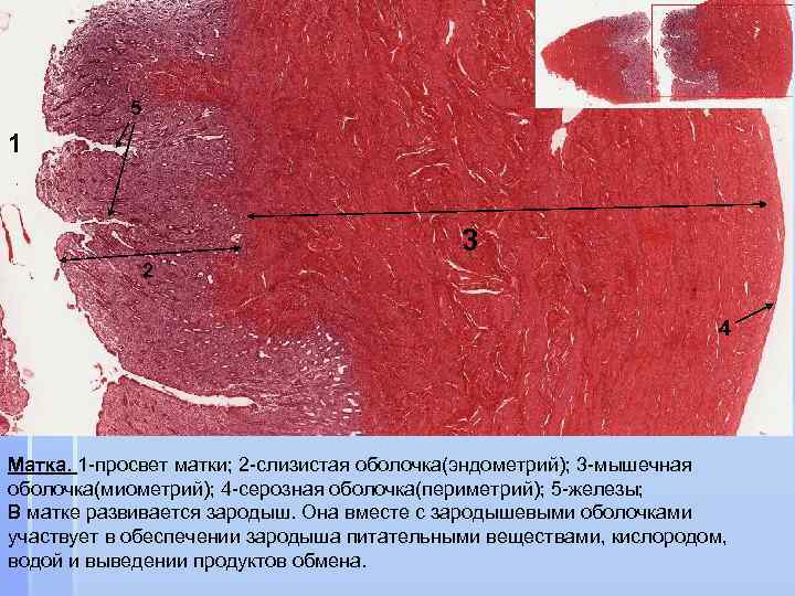 5 1 3 2 4 Матка. 1 -просвет матки; 2 -слизистая оболочка(эндометрий); 3 -мышечная