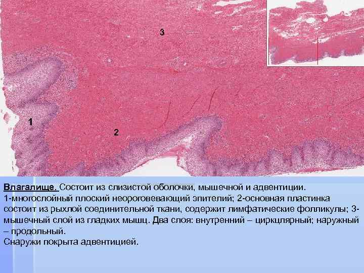 3 1 2 Влагалище. Состоит из слизистой оболочки, мышечной и адвентиции. 1 -многослойный плоский