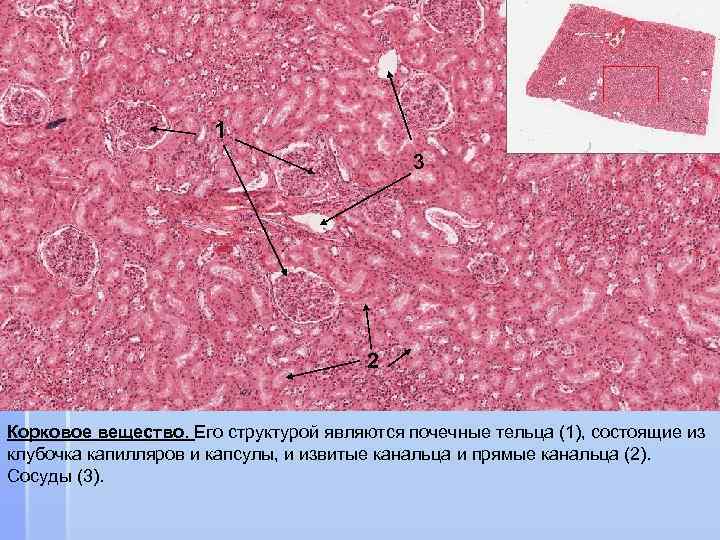 Почечное тельце корковое вещество. Почечные тельца гистология. Почечное тельце гистология. Структуры коркового вещества почки почечные тельца. Капиллярный клубочек гистология.