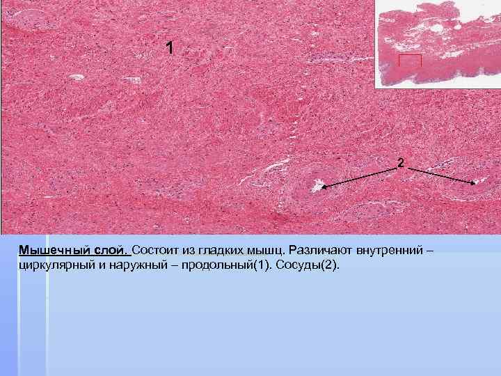 1 2 Мышечный слой. Состоит из гладких мышц. Различают внутренний – циркулярный и наружный