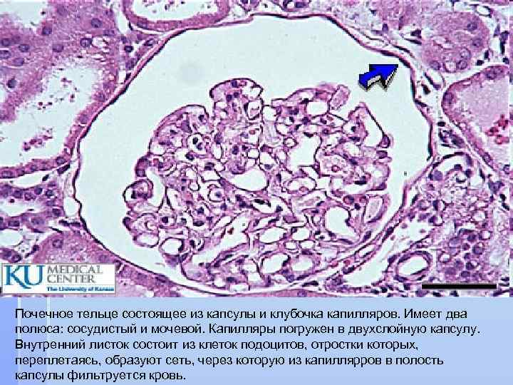 Почечное тельце состоящее из капсулы и клубочка капилляров. Имеет два полюса: сосудистый и мочевой.