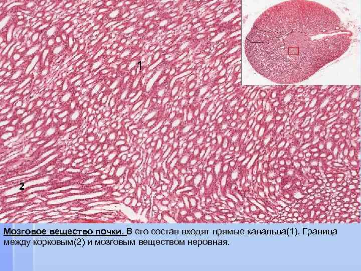 Вещество почки. Мозговое вещество почки гистология. Мозговое вещес во почк. Пирамида мозгового вещества почки. Корковое и мозговое вещество почки препарат.