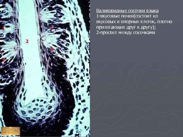 1 1 2 2 1 1 1 Валиковидные сосочки языка 1 -вкусовые почки(состоит из