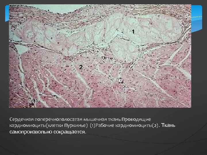 1 2 Сердечная поперечнополосатая мышечная ткань Проводящие кардиомиоциты(клетки Пуркинье) (1)Рабочие кардиомиоциты(2). Ткань самопроизвольно сокращается.