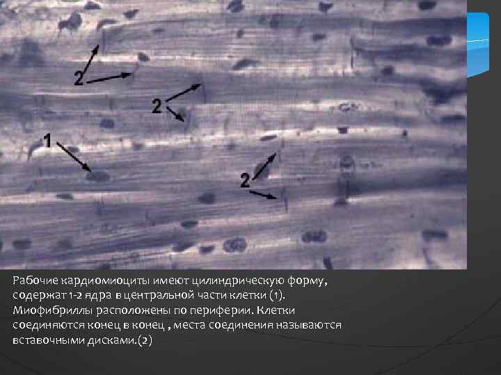 Рабочие кардиомиоциты имеют цилиндрическую форму, содержат 1 -2 ядра в центральной части клетки (1).