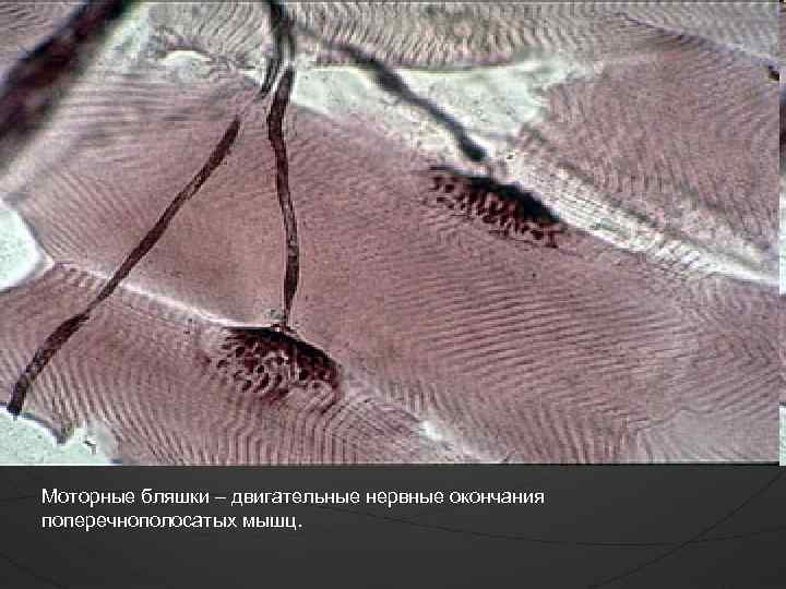 Моторные бляшки – двигательные нервные окончания поперечнополосатых мышц. 