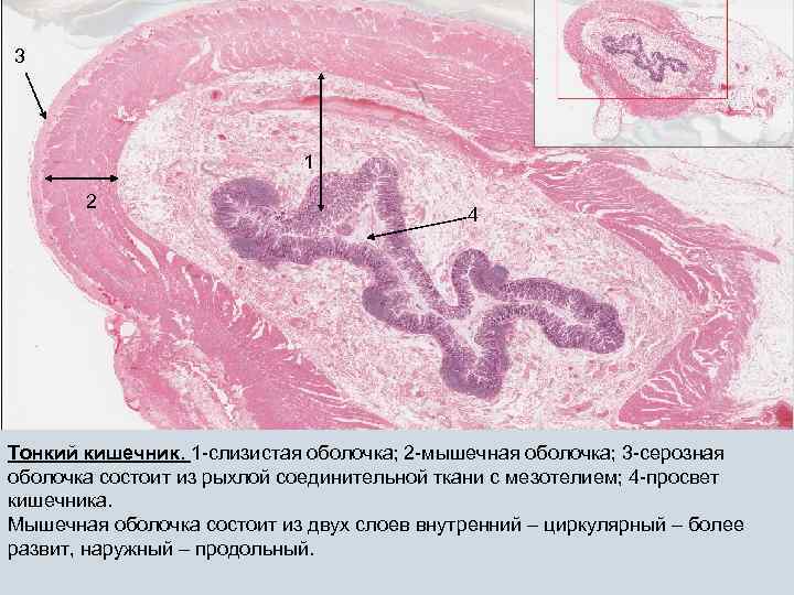 3 3 1 1 2 2 4 4 Тонкий кишечник. 1 -слизистая оболочка; 2