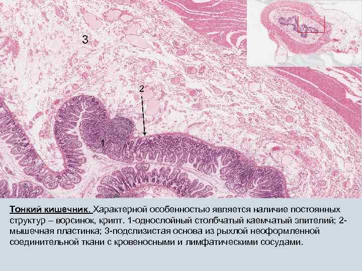 3 2 1 Тонкий кишечник. Характерной особенностью является наличие постоянных структур – ворсинок, крипт.