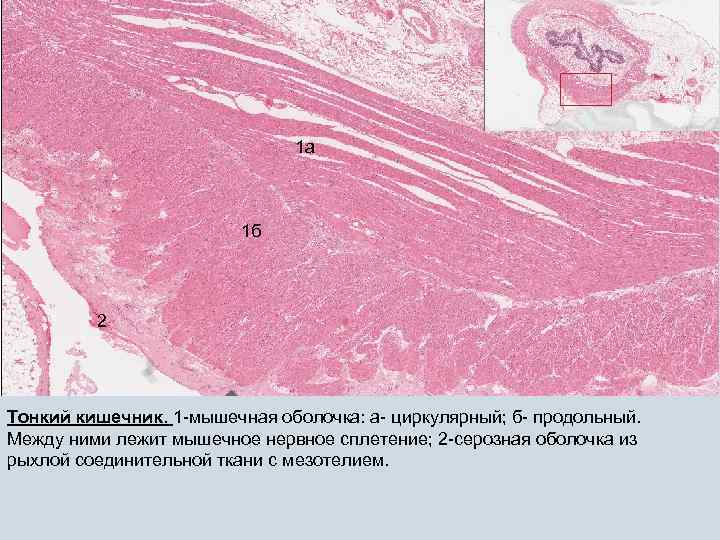 Ауэрбахово сплетение