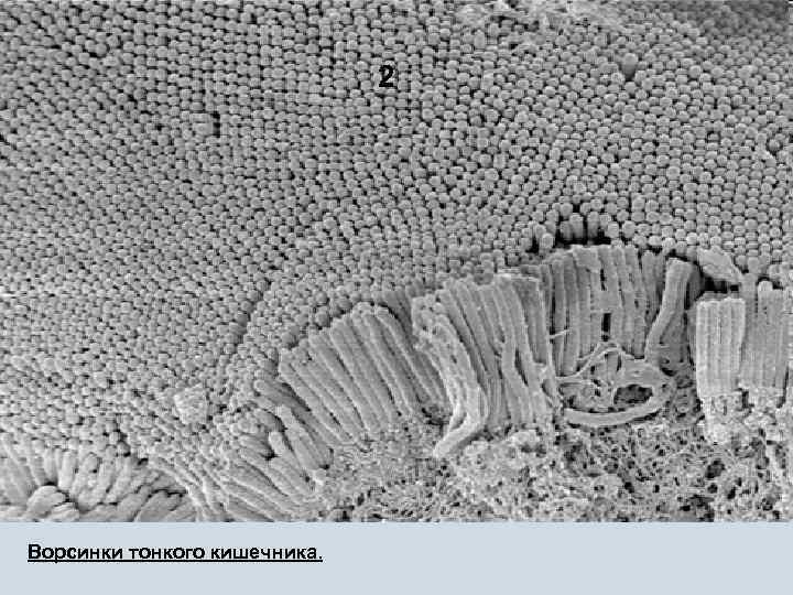 2 Ворсинки тонкого кишечника. 