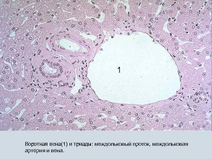 1 Воротная вена(1) и триады: междольковый проток, междольковая артерия и вена. 