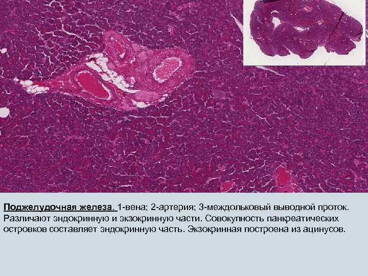 Поджелудочная железа. 1 -вена; 2 -артерия; 3 -междольковый выводной проток. Различают эндокринную и экзокринную