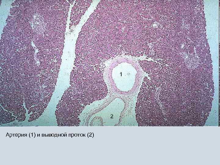 1 2 Артерия (1) и выводной проток (2) 