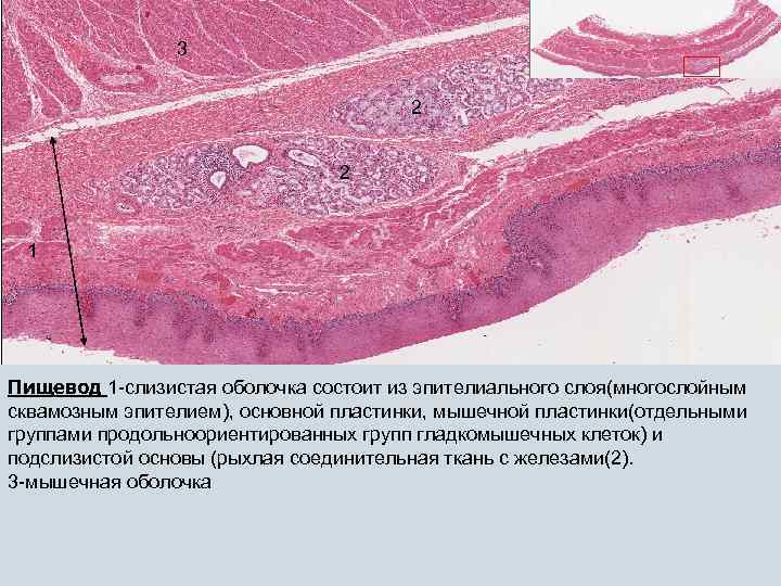 3 2 2 1 Пищевод 1 -слизистая оболочка состоит из эпителиального слоя(многослойным сквамозным эпителием),
