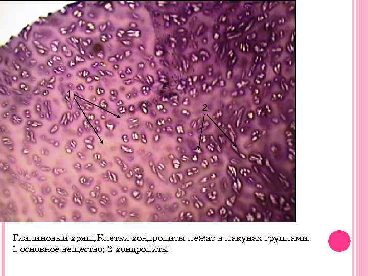 1 2 Гиалиновый хрящ. Клетки хондроциты лежат в лакунах группами. 1 -основное вещество; 2