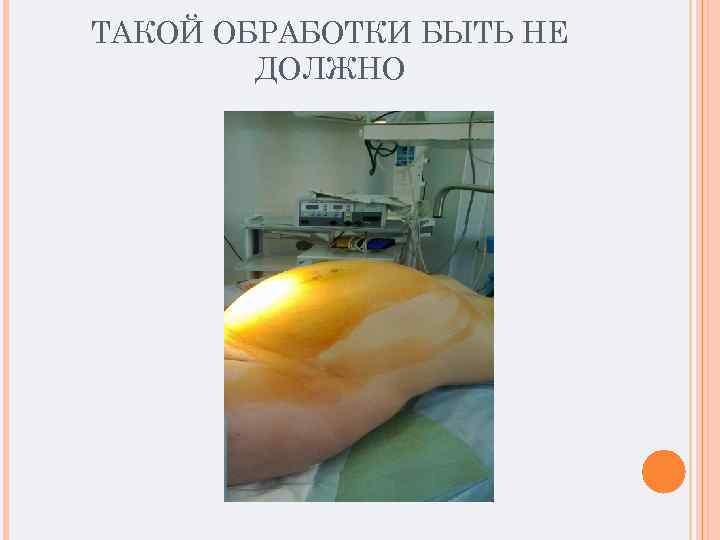 ТАКОЙ ОБРАБОТКИ БЫТЬ НЕ ДОЛЖНО 