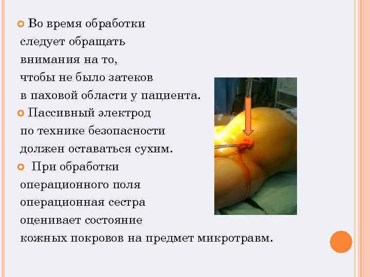Во время обработки следует обращать внимания на то, чтобы не было затеков в паховой